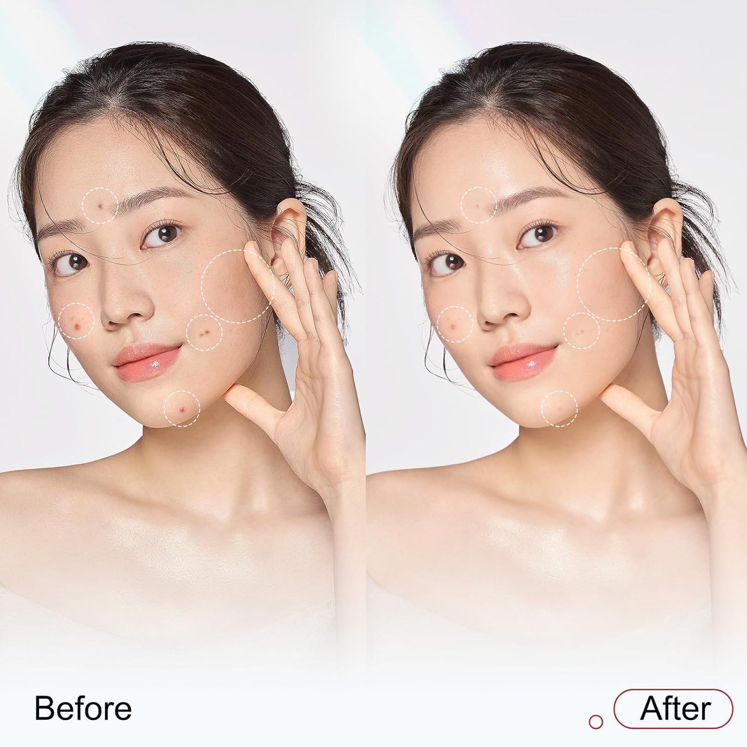 Suero de Niacinamida 10% con Corrector de Manchas Oscuras